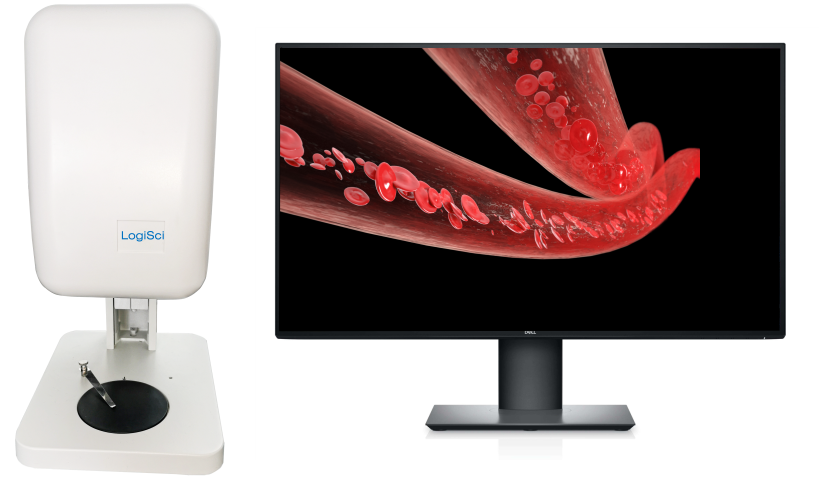 高分辨激光血流成像系统